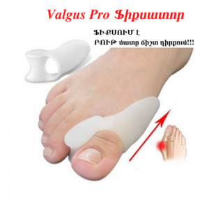 Ոտքի կոճի ֆիքսատոր Valgus Pro